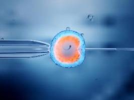 Mama, Papa, Spenderin: Gesunde Babys mit DNA von drei Personen geboren