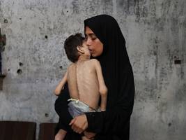 Hungersnot im Gazastreifen: „Zum Sterben zu viel, zum Leben zu wenig“