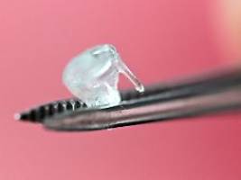 Große Hoffnung Bioprinting: Wann kommen unsere Organe aus dem Drucker?