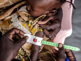 globale gesundheit: „der körper ist dann dauerhaft auf mangel getrimmt“