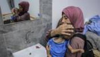 Hunger in Gaza: Das Kind aus Gaza, über das die Welt spricht