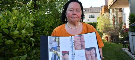 Diese Frau wartete 50 Jahre auf eine Diagnose – und kämpft für alle Lipödem-Patientinnen