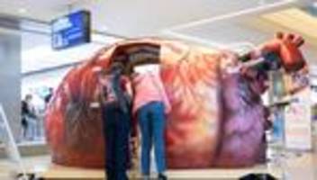 Gesellschaft: World Transplant Games – Kritik an Organspendepolitik