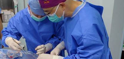 Transplantation in China: Mediziner transplantieren erstmals Schweinelunge in Hirntoten