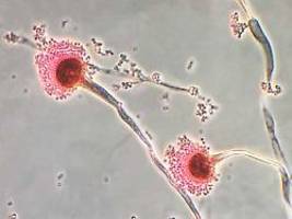 Gefahr beim Einatmen der Sporen: Was Schimmelpilz noch tödlicher macht