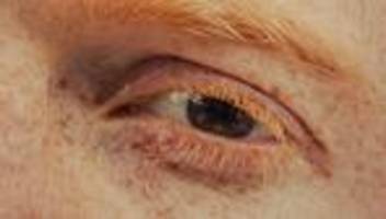 Psychische Krankheiten: So viel Psyche wird vererbt