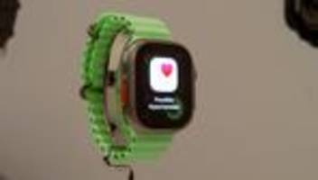 Apple Watch: Der Arzt am Handgelenk
