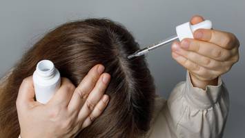 dichteres haar durch minoxidil? „erstmal fallen die haare aus“