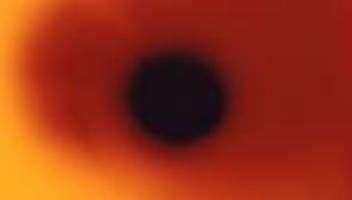 Nebenwirkungen von Ozempic: Wie sicher sind die Abnehmspritzen?