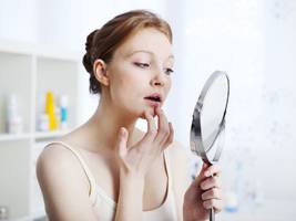 Dermatologie: Ist das wirklich der Durchbruch gegen Akne?