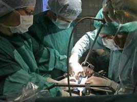 Patient lebte noch 171 Tage: Schweineleber in lebenden Menschen transplantiert