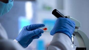 Neue Antibiotika: Wie KI im Kampf gegen Superkeime helfen kann