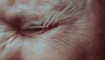 Psychische Gesundheit: Psychisch belasteter denn je