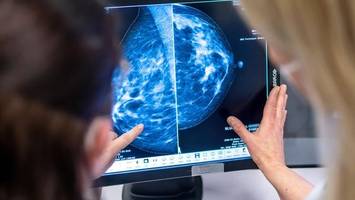 Impfstoff gegen Krebs: Forscher melden Erfolg bei Mäuse-Test