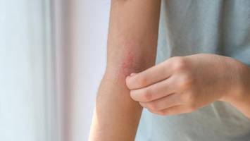 Diabetes-Symptome: Experte erklärt die häufigsten Warnzeichen