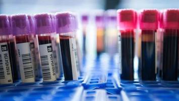 Mikronährstoffanalyse: Mit diesem Ergebnis habe ich nicht gerechnet