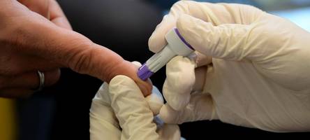 Kostenloser HIV-Testtag in Augsburg