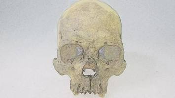 rätselhafte spuren einer krankheit im präkolonialen amerika