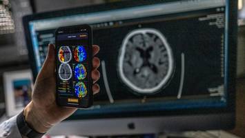 schlaganfall: „jede minute entscheidet über das ausmaß der schäden“