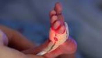 Medizin: 16 Wochen zu früh: Intensive Pflege rettet Baby das Leben