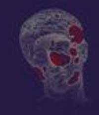 Chronische Schmerzen : Man kann sich nicht an Schmerzen gewöhnen. Aber man kann sie verlernen