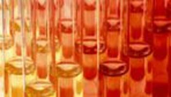 leistungsdruck in der wissenschaft: setzt der uni grenzen!