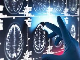 Wird Blarcamesin zugelassen?: Experten zweifeln an neuer Alzheimer-Tablette