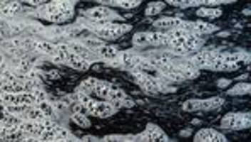 Hamburg: Polio-Wildvirus taucht erstmals wieder im Abwasser auf