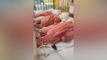 Eineiige Drillinge geboren: Ärzte begeistert über „kleines Wunder“