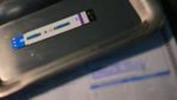 Immunschwäche-Virus: Schätzung: 2.300 neue HIV-Infektionen im Jahr 2024