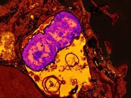 wenn antibiotika versagen: rki warnt vor zunahme resistenter super-erreger