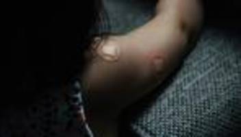 Impflücken: WHO warnt vor Masernausbrüchen