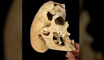spanien: archäologen rätseln über seltsame schädelform eines ritters