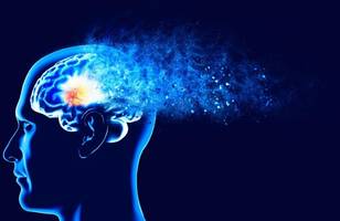 Bekannter Wirkstoff könnte Alzheimer-Symptome auflösen