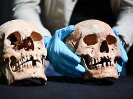 rektorin bittet um verzeihung: einbrecher stehlen wichtigen schädel aus anatomie der uni köln