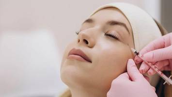 Mein erstes Mal Botox: Mit dieser Wirkung hätte ich nicht gerechnet