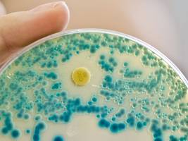 medizin: wie kommt die welt zu neuen antibiotika?