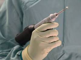 Bohrte sie Loch in Schädel?: Zwölfjährige am OP-Tisch: Gericht spricht Chirurgen frei