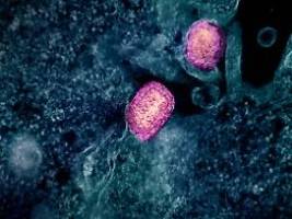 gefahr durch virus-mutante?: neue hybride mpox-variante in großbritannien entdeckt