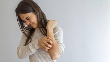 Utas ganzer Körper juckte ständig: „Sie sagten, ich soll zum Psychologen“