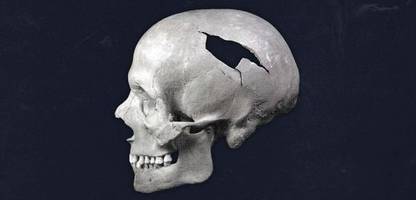 leibarzt von friedrich wilhelm: archäologen entdecken skelette im garten