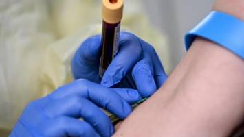 Warum ich Cholesterinwerte eines „alten, dicken Mannes“ habe