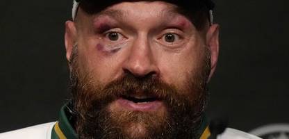 Boxen: Tyson Fury mit erneuter Rückkehr