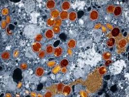 infektiologe warnt vor erregern: diese viren könnten uns 2026 gefährlich werden