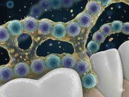 Auslöser im Mund?: Karies-Bakterium steht unter Parkinson-Verdacht