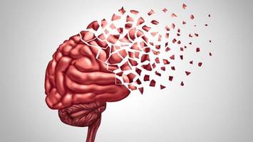 „Ist eine grausame, grausame Krankheit“: 24-Jähriger stirbt an seltener Demenz