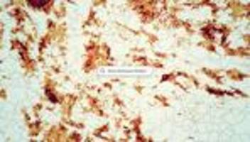 Mobiles Internet in Deutschland: Wo Ihr Handybrowser lädt. Und lädt. Und lädt. Und lädt