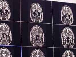 diagnose im alter von 22: bisher jüngster demenz-patient großbritanniens ist tot