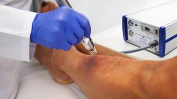 wunden verschließen mit kaltplasma: diese firma liefert medizin-hightech