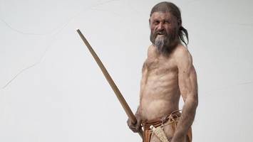 Ötzi: DNA-Analyse enthüllt schwerwiegenden Krankheitserreger